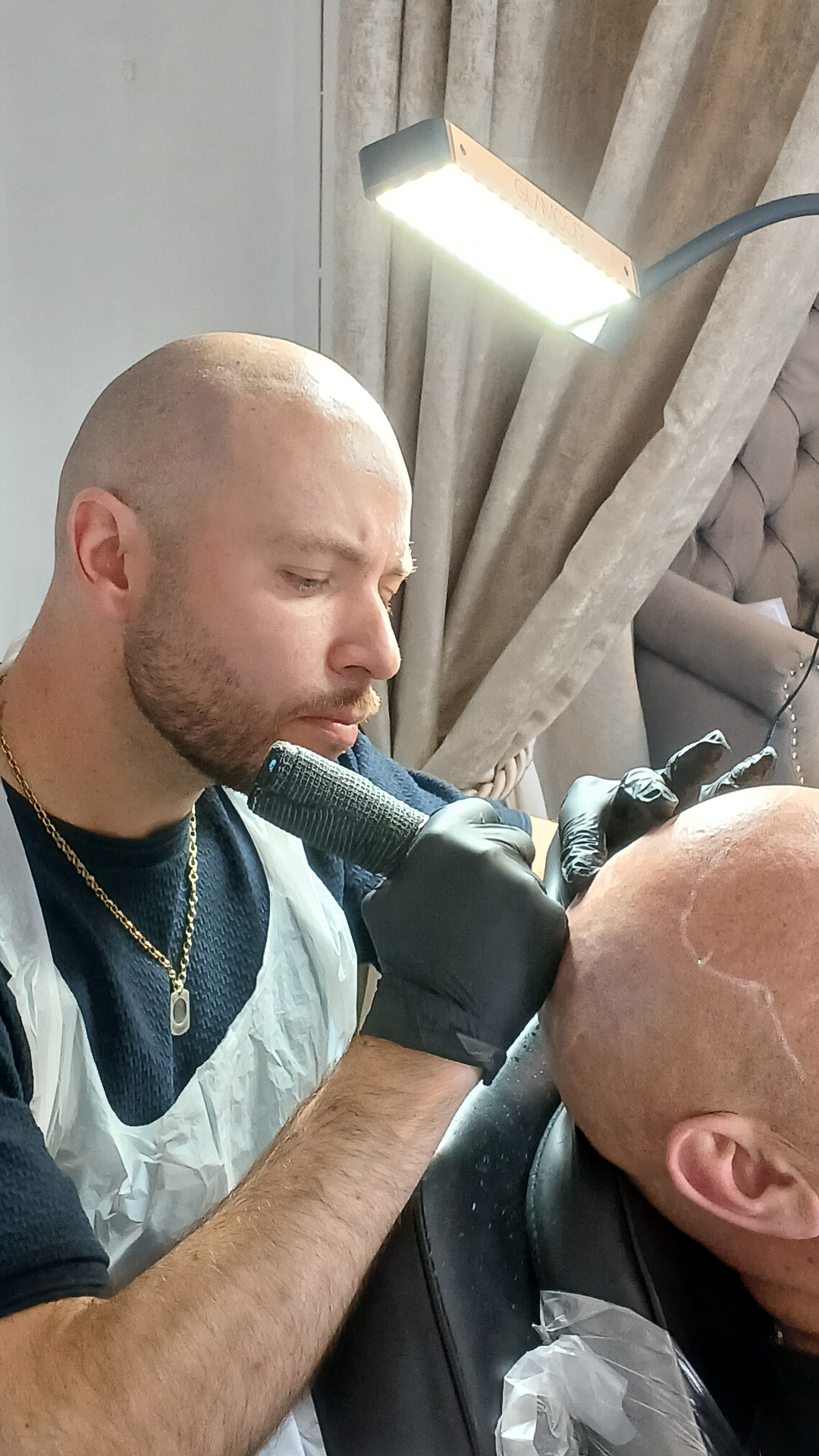 Man with precision scalp micropigmentation hairline — SMP by Jack, Newport